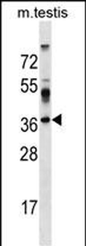 SURF4 Antibody (C-term)