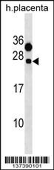 CLEC6A Antibody (C-term)