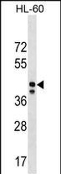 MRPS31 Antibody (Center)