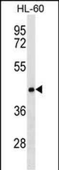 CLN8 Antibody (C-term)