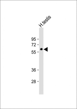 GMCL1L Antibody (C-term)