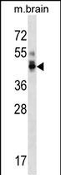 PPP1R7 Antibody (C-term)