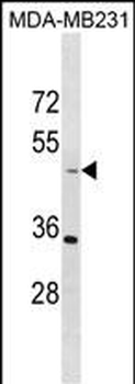 TAPBP Antibody (N-term)