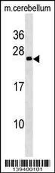 mouse BAD Antibody (Center S112/S111/Y113)