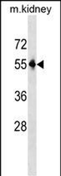 Mouse Pnpla3 Antibody (C-term)