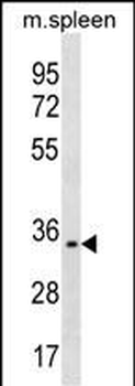 TREML1 Antibody (C-term)