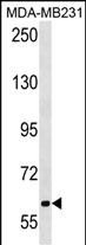 TRPC4AP Antibody (N-term)