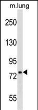 DNAJC10 Antibody (N-term)