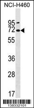 PKD2L2 Antibody (Center)