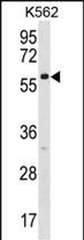 ZNF212 Antibody (N-term)