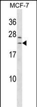 SAP30L Antibody (Center)