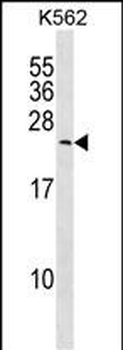 MYL6B Antibody (Center)
