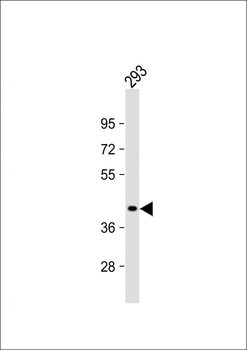 GIPC2 Antibody (C-term)
