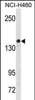 KIT Antibody (Center S746)
