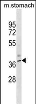 Mouse Kcnj11 Antibody (N-term)