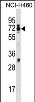 Mouse Csrnp2 Antibody (N-term)
