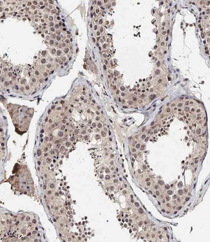 BRD9 Antibody (N-term)