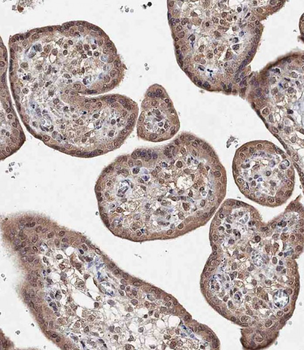 BRD9 Antibody (N-term)