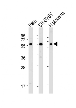 BRD9 Antibody (N-term)