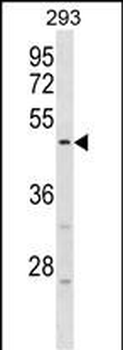 HORMAD1 Antibody (Center)