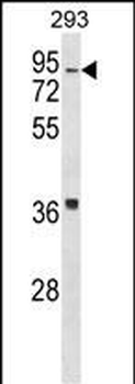 HIRIP3 Antibody (Center)