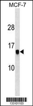 HIST1H2AG Antibody (C-term)