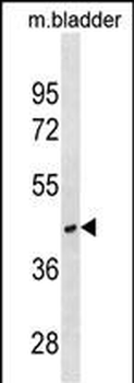 RAB40C Antibody (Center)