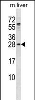 RAB5B Antibody (Center)