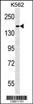 HEPHL1 Antibody (N-term)