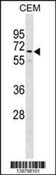 GOLGA8B Antibody (N-term)