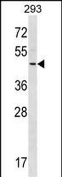 RNF41 Antibody (C-term)