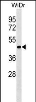 ERLIN2 Antibody (C-term)