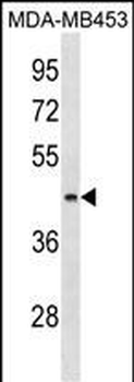 ALG8 Antibody (N-term)