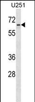 ZNF768 Antibody (N-term)