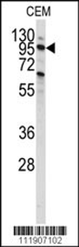 PI3KC3 Antibody (S851)