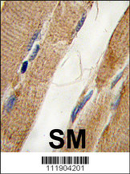 PI3KC3 Antibody (S425)