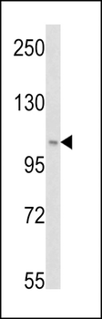 PI3KC3 Antibody (S34)