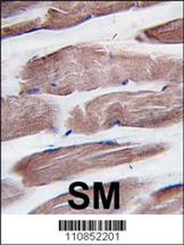 PI3KC3 Antibody (N-term G24)