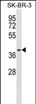 SFXN3 Antibody (C-term)