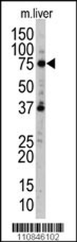 UVRAG Antibody (L133)