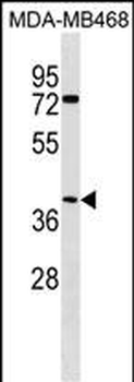 ABHD1 Antibody (C-term)