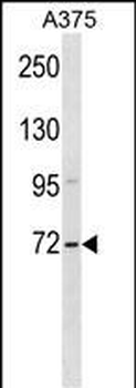 ZSWIM2 Antibody (C-term)