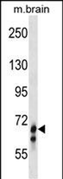 GLB1L Antibody (N-term)