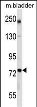 GCLC Antibody (Center)