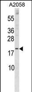 SNX3 Antibody (Center)
