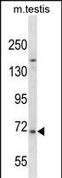 EXTL1 Antibody (C-term)