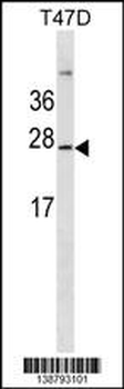 GKN3P Antibody (Center)