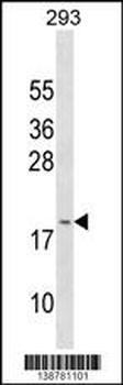 GAGE3 Antibody (N-term)