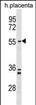 PAPD5 Antibody (N-term)