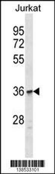 OR1C1 Antibody (C-term)